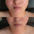 이케이뷰티 | 진주 평안동 이케이뷰티 인모드 리프팅 후기! 탄력·윤곽 한번에 잡은 꿀관리