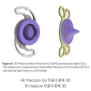 대구 백내장수술,프리시존고 토릭 렌즈 수술 후기(2025년 최신 인공수정체)
