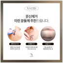 서울본의원 | 문신제거 1회차 받아본 후기