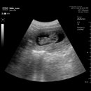 지엠메디칼 이미지