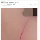 초딩 4학년이 연필로 얼굴 그어놓음 ㄷㄷㄷ 이미지