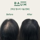 바움SMP