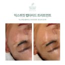 이천피부관리 모공케어 솔직 후기 이천 피부관리 헤르츠뷰티라운지 리뷰와 효과 정리하기