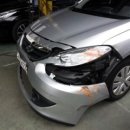 1급CT자동차 이미지