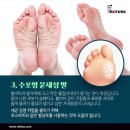 레푸스 화정점 이미지