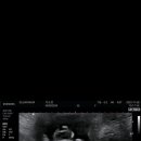 신림라움산부인과의원 이미지