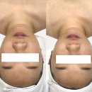 롯데리아 전주에코점 | 전주 에코시티 피부샵 더예뻐지다 에스테틱｜저자극 필링 관리 솔직후기