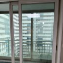 뷰 클리닝 이미지