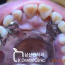 RPD치과기공소 이미지