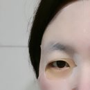 더블유 테라피(W Therapy) 이미지
