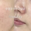 앤스킨(annskin)