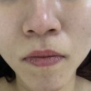 마이주주 | [전주피부부관리맛집] 전주에스테틱추천 주주에스테틱 탄력관리