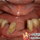 수플란트치과병원 이미지