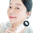 주메디 | 뷰티디바이스 추천 쿠쿠 메디킨 하이 고주파 피부리프팅 기기 4주후기