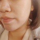 인천 웨딩케어 부평 피부관리 토탈뷰티샵 LDM관리 포티산 스킨멀티플렉스 강력추천 후기
