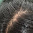 준스헤어 이미지