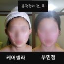 케어셀라 네이버블로그