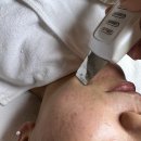 삼송피부관리 유빛에스테틱 여드름케어전문 에스테틱 / 내돈내산 피부 스케일링 관리받기!