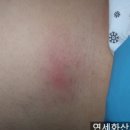 연세화산외과 이미지