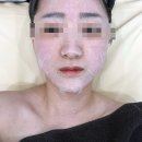 수원 율전동 피부관리 추천 / [에스테틱 서윤] 출산 후 관리 리프팅 후기