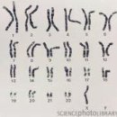 특수아상담 이미지