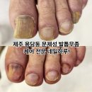 동광로1길 80 | 제주 용담동 문제성 발톱무좀 케어 전문 네일하루(80대 어르신 관리 후기)
