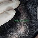 두피타투,두피문신,여성원형탈모,여성빈머리,두피땜빵타투,두피흉터커버타투,두피타투잘하는곳 이미지