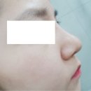 엠의원 | 진료비 지원, 스마일닥터! 분당 성형외과 수내 엠의원 이용 후기