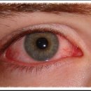 하드렌즈샵안경원 이미지