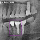 부평아트치과의원 이미지