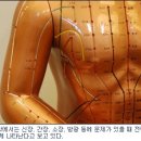 빛샘한의원 노컷뉴스