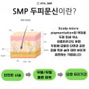 알기쉬운 서각기법 | 강동구 탈모, 이렇게 바뀔 수 있습니다