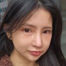 당감조아조아뽑기샵 | <눈밑지방재배치> 눈밑 필러 대신 눈밑지 내돈내산 일주일 경과 후기 (무보정, 무필터)