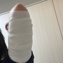 6 | 대구 타투제거 6회차 후기