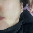 장유피부관리 디나인뷰티 블랙필 후기