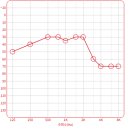 목동독일보청기 | [독일 현 보청기] 고급형 보청기 후기