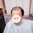 김호증모가발춘천체인점 이미지