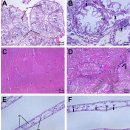 톱날꽃게 십각목무지개바이러스병(decapod iridescent virus 1, DIV1) 이미지