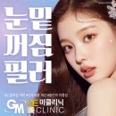 터치미의원 | 눈밑꺼짐필러후기 후관리 유지기간 추천 비교효과