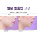마린시티치과교정과치과의원 네이버블로그