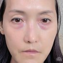 나무메디 | 여드름 피부 트러블진정 약국화장품 메디포엘 추천