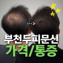 부천시청역 | 부천시청역두피문신 후기, 인위적인 느낌 싫어하는 분들 보세요
