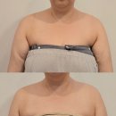 인천 계산동 에스테틱 맛집 뷰티앤스킨 등관리 내돈내산 후기
