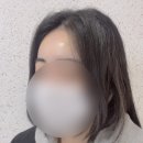 [서울/논현] 논현성형외과 첫! 이마 필러 후기
