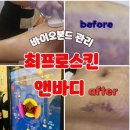 최이용샵 | 대전 예신관리의 숨은 보석, 장대동피부관리 최프로스킨앤바디에서 바본관리