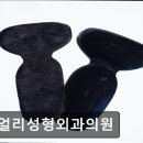 쥬얼리성형외과의원 네이버블로그