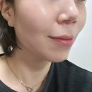 사과나무스킨케어 네이버블로그