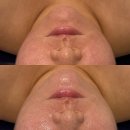 삼계풍림위너스타운 | [김해/삼계] 김해 삼계피부관리 삼계웨딩관리 빈스뷰티 작은얼굴 관리 후기