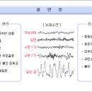 불면증이란? 이미지