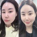 동대신동역 8번출구 앞 | 신사역 8번출구 바로앞 효과만점 관자필러 후기